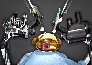 photo of surgical robot
