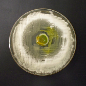 petri dish showing zone of inhibition