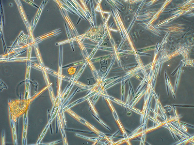 microscope image of algal cells