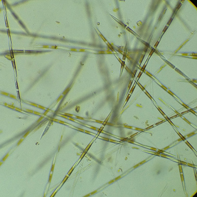 microscope image of diatoms
