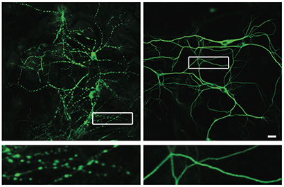 mouse hippocampal neurons