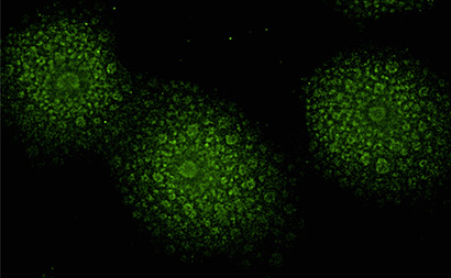 neurons stained green