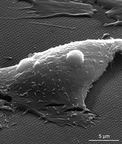electron microscope image of cell