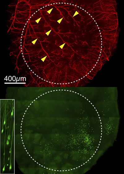 microscope images of neurons and blood vessels in brain