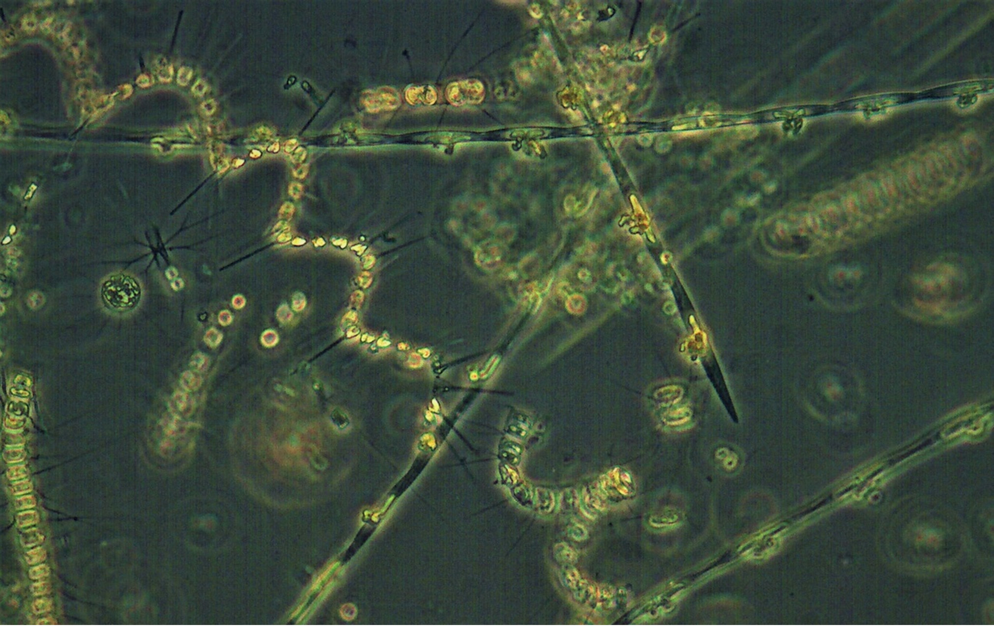 microscope image of phytoplankton