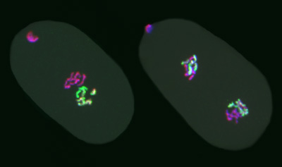 cells with colored chromosomes