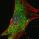 astrocyte-thumb.jpg