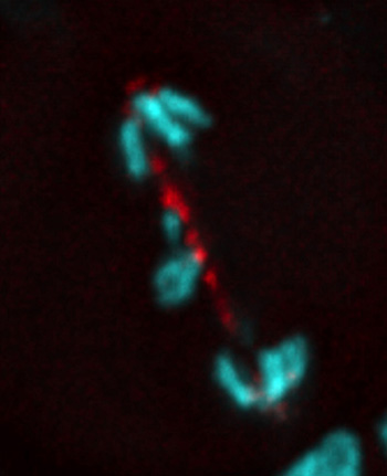 DNA tether attached to chromosome fragment