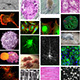 hca-cells-thumb.jpg