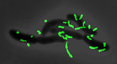cholera bacteria with pili in green