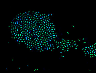 bacteria-bluegreen-400.jpg