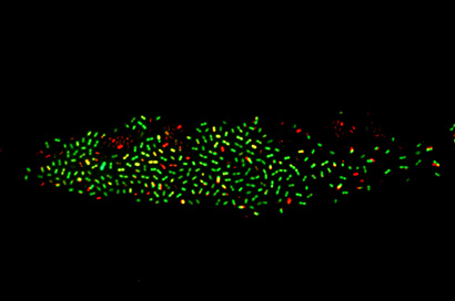 bacteria2-redgreen-410.jpg