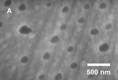 SEM image of nanoparticles
