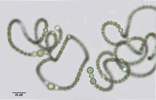 green cyanobacterial cells under microscope