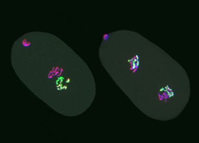embryo-chromosomes-410.jpg