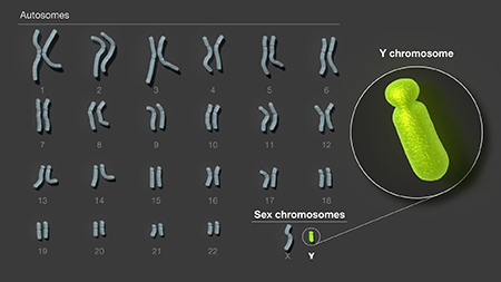 All of the human chromosomes as the appear in the body