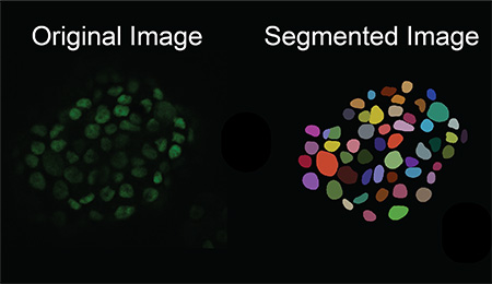 Faded image of cells vs an example of cell segmentation, the latter as colored blobs.
