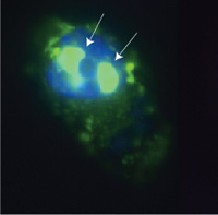 Researchers trace effects of genetic defect in myotonic muscular dystrophy