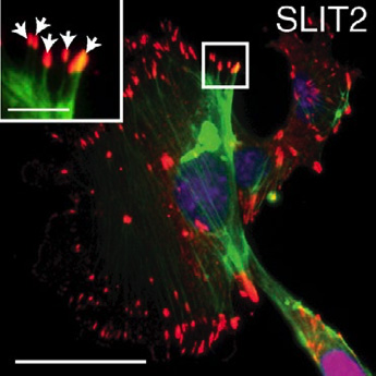 Cellular response to tissue stiffening may delay progression of breast cancer