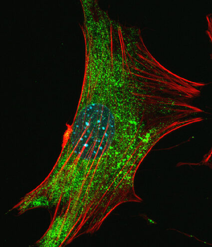 Study implicates glial cells in fragile X syndrome