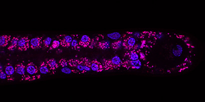 Basic research in fruit flies leads to potential drug for diseases afflicting millions