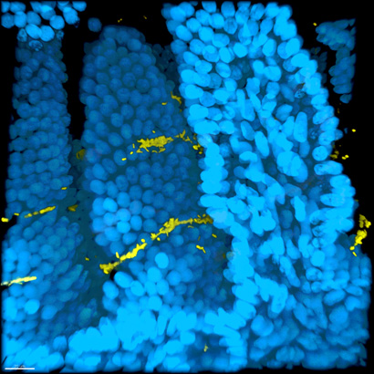 Cholera studies reveal mechanisms of biofilm formation and hyperinfectivity