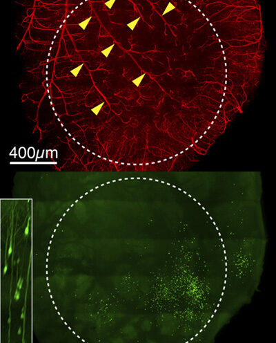 Tracing neurons in the visual cortex sheds light on brain’s circuitry