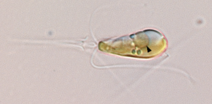 Light microscopy image showing the marine haptophyte algae Braarudosphaera bigelowii with a black arrow pointing to the organelle.
