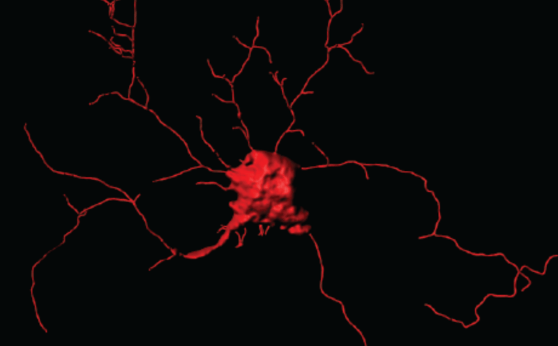 Brain cells are more plastic than previously thought, study shows