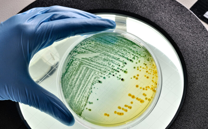 UCSC-led international collaboration sheds new light on bacterial mechanisms of antibiotic resistance