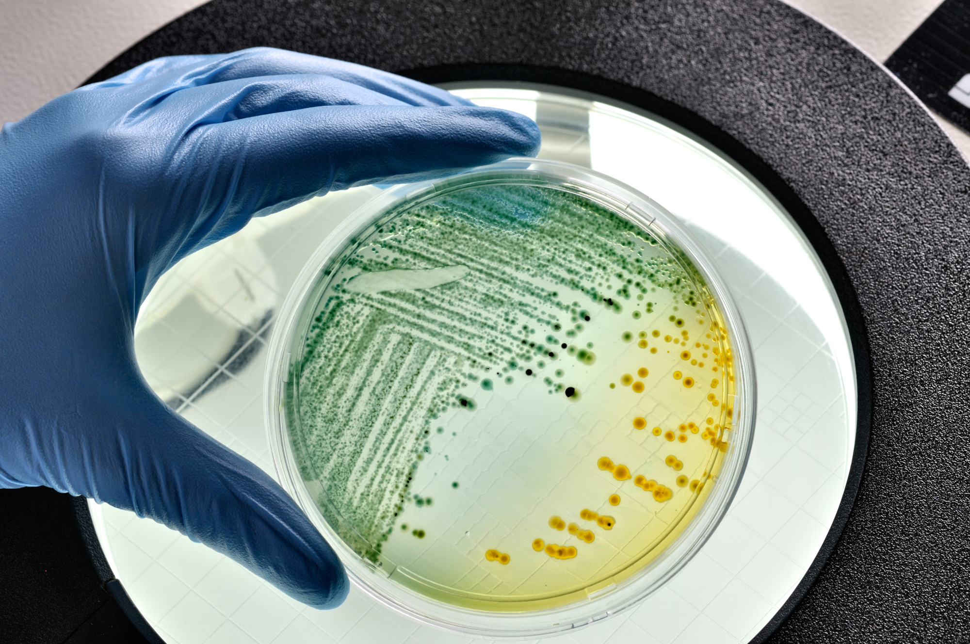 E. coli bacteria growing in laboratory dish inspected in a food laboratory