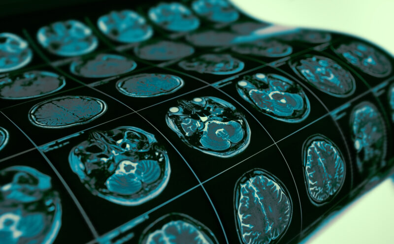 Revealing the secrets of the human brain