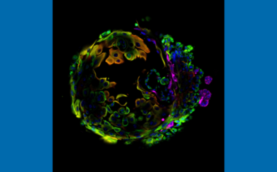 Magnified cells outlined in different colors grouped in a circle