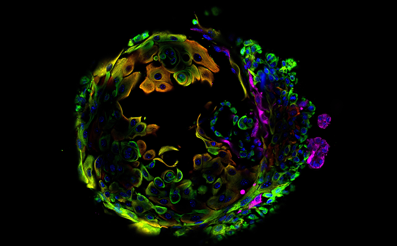 How early pregnancy impacts aging: implications for breast-cancer risk