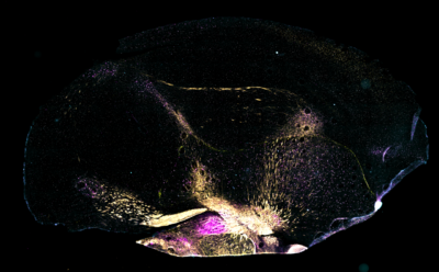 Cross-section of finch brain, with colors representing different types of neurons.