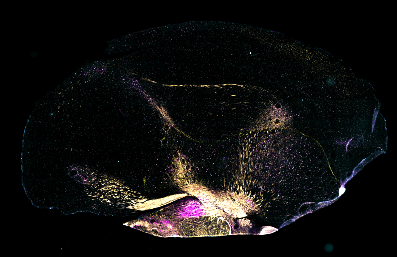 Cross-section of finch brain, with colors representing different types of neurons.
