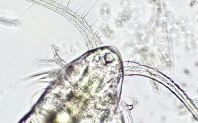 Magnified image of specimen under a microscope
