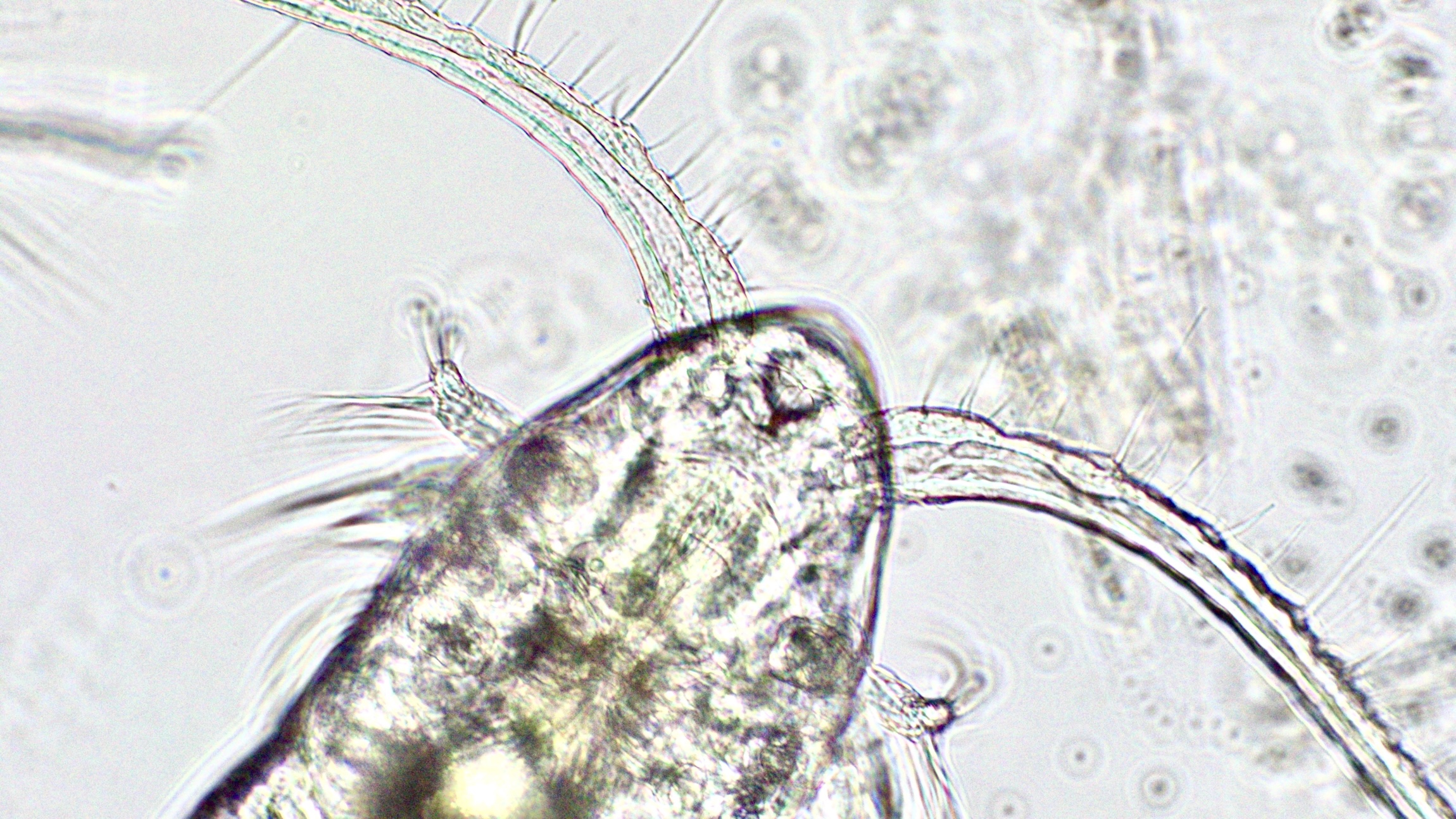Magnified image of specimen under a microscope