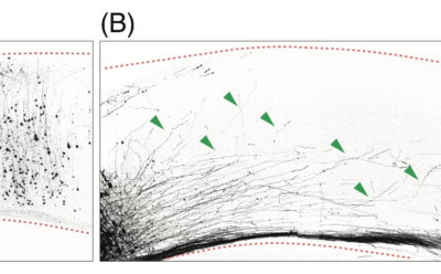 Magnification of nerve-fiber growth, shown from two perspectives