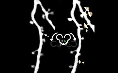 Two strands of dendrites with a cartoon mouse head in between and small mushrooms branching from dendrite on the right